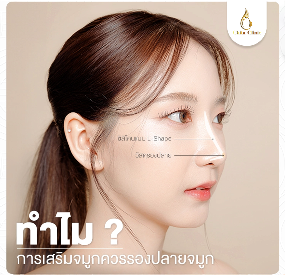ทำไมการเสริมจมูก ควรรองปลายจมูก