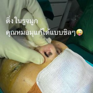 nose_2